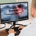 Why X-Rays Are Essential For Emergency Dental Care In Rockville, MD