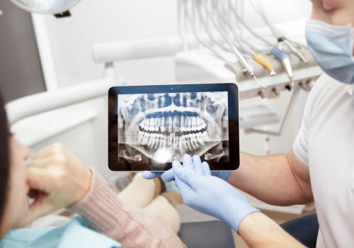 Understanding The Importance Of Dental X-Rays For Your Oral Health In Thornhill