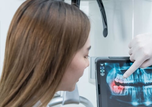 From Diagnosis To Treatment: The Role Of Dental X-Rays In North Kansas City