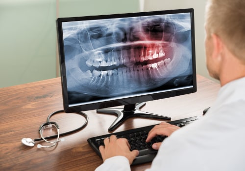 Why X-Rays Are Essential For Emergency Dental Care In Rockville, MD